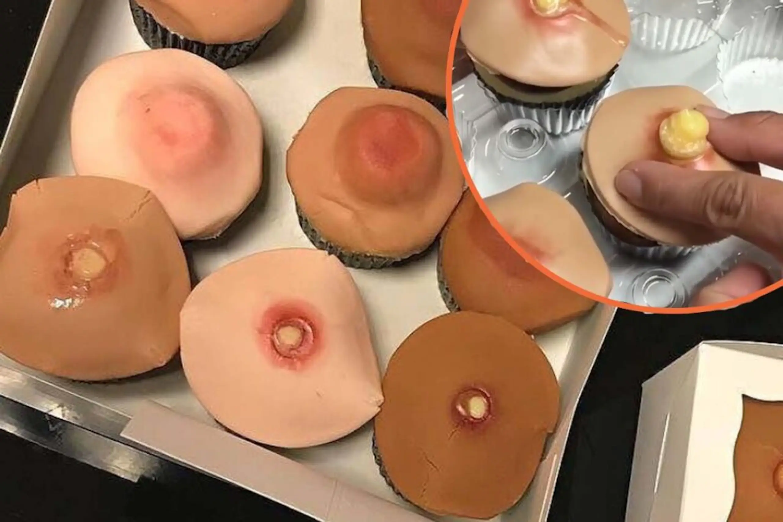 Baker creates a pimple cupcake that oozes ‘pus’ when you squeeze it