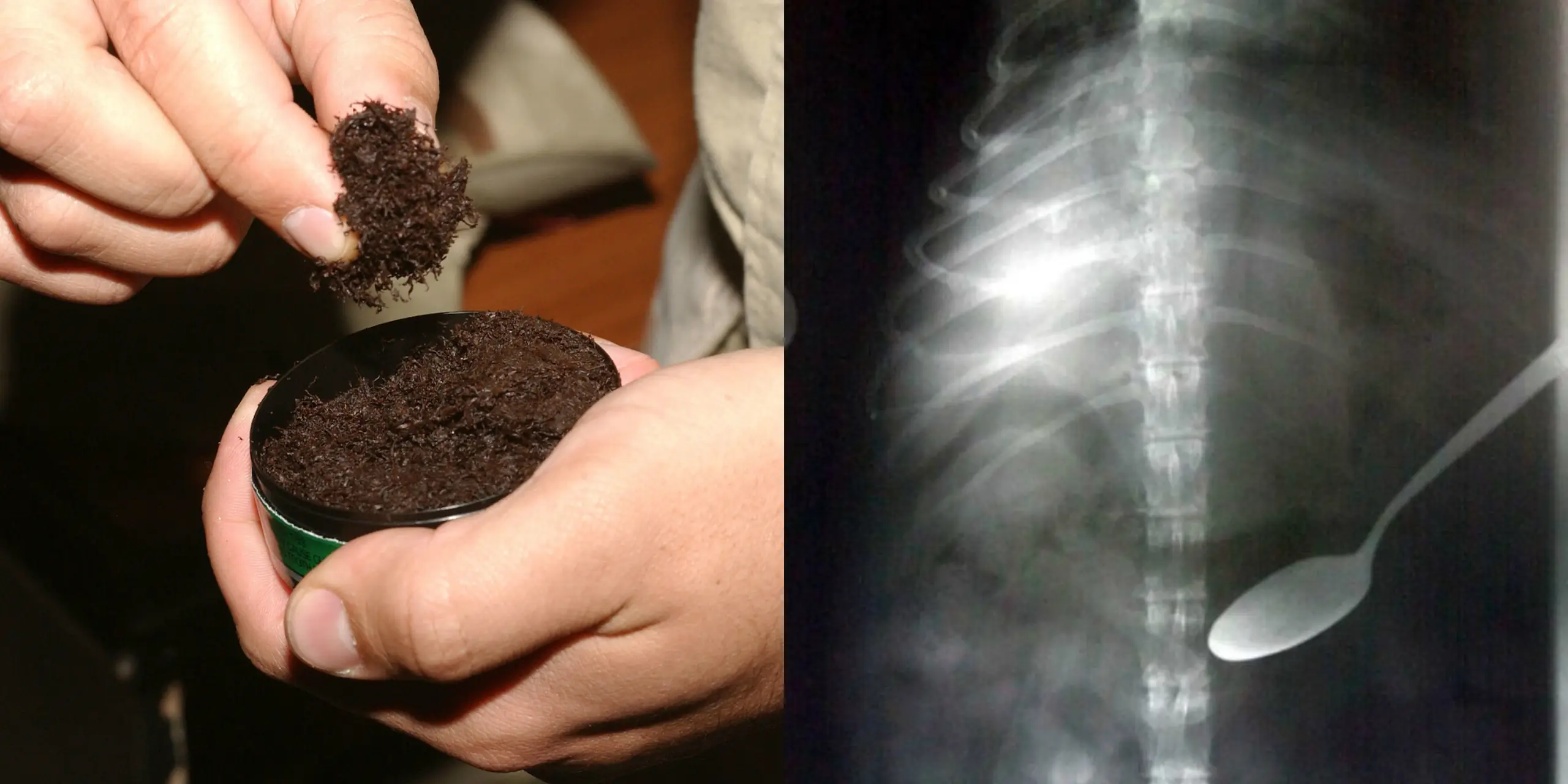 Insane Things People Have Actually Swallowed