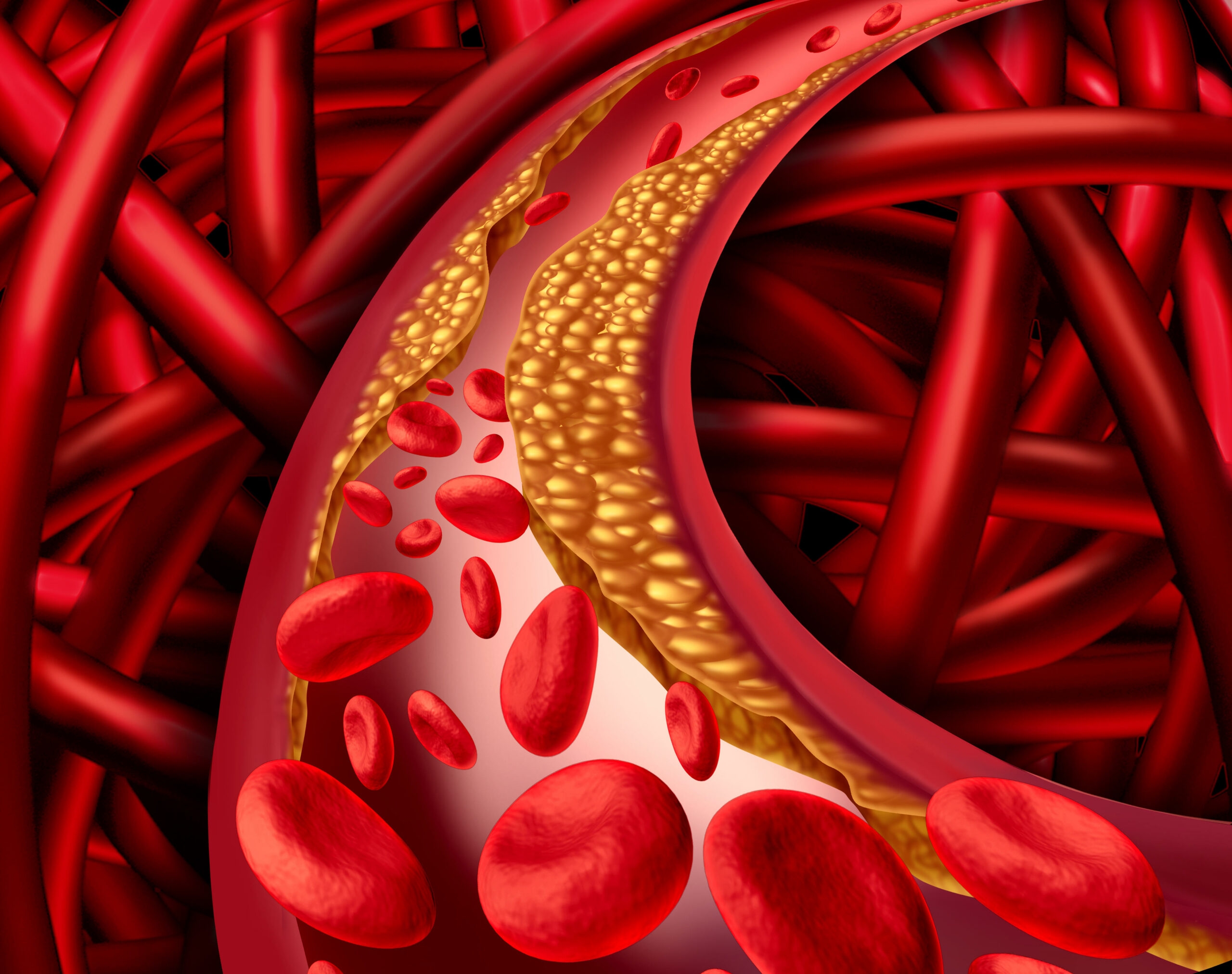 Cholesterol blood